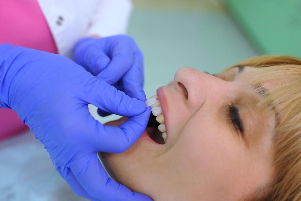 Ultra-Thin Lumineers® vs. Traditional Veneers: Which Is Right for You?