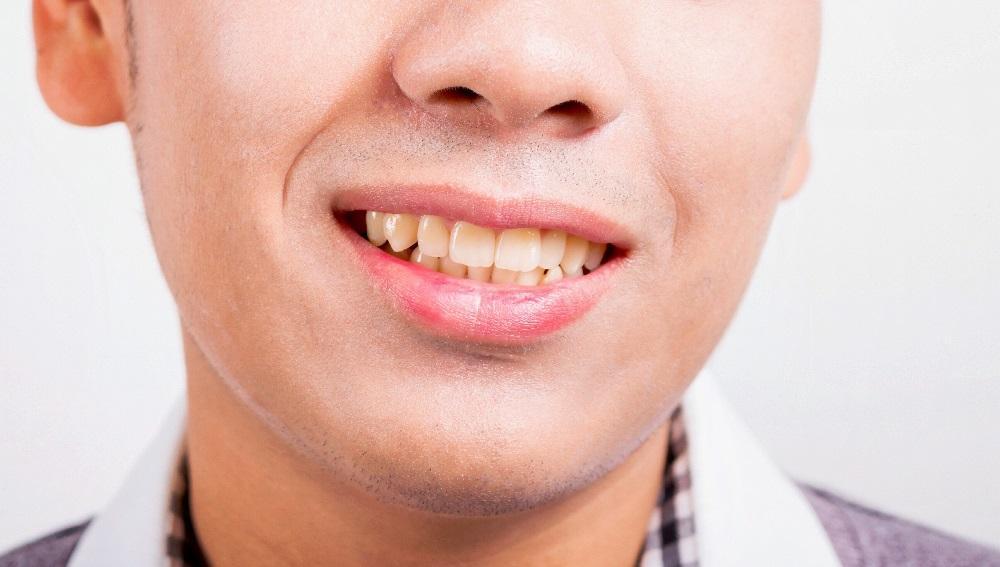 Signs Your Oral Health Isn’t As Great As You Think It Is