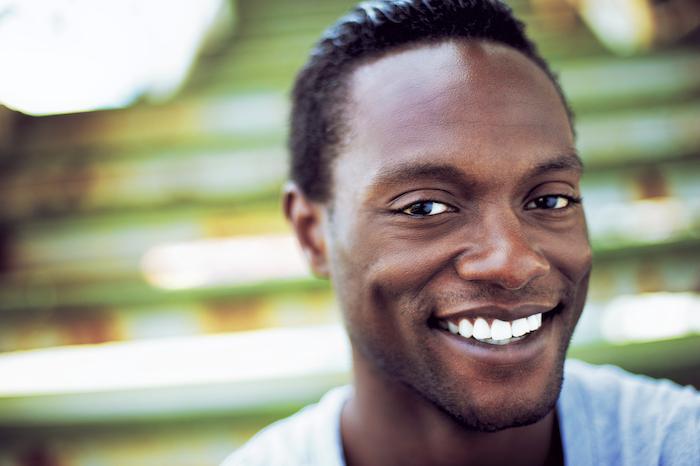 How Does Professional Teeth Whitening Work at Home?